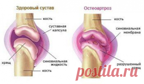 Суставы