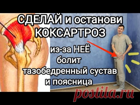 Сделай и останови КОКСАРТРОЗ / из-за этой мышцы болит тазобедренный сустав и поясница + перекос таза