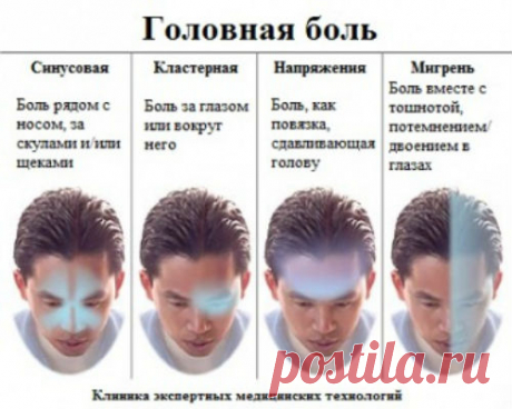 Гид по головной боли: мифы, виды, лечение - Народная медицина - медиаплатформа МирТесен