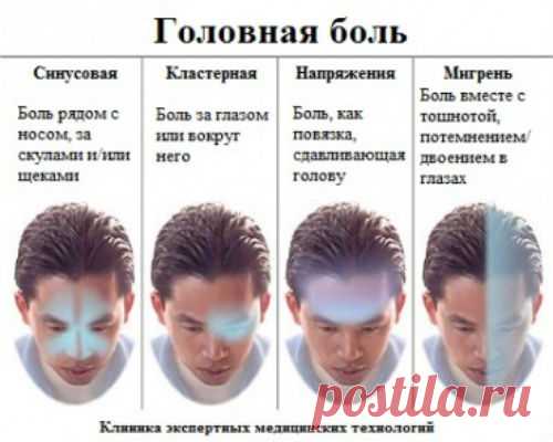 Гид по головной боли: мифы, виды, лечение - Народная медицина - медиаплатформа МирТесен