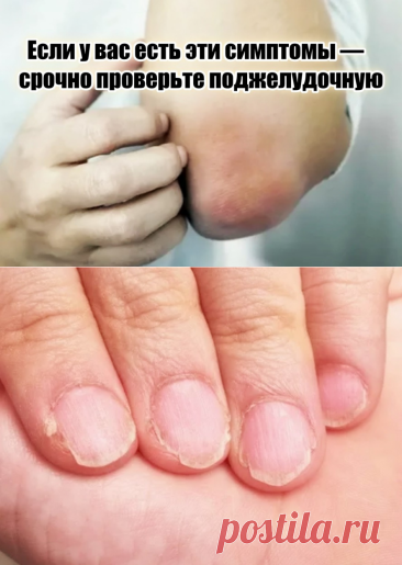 (3) Одноклассники