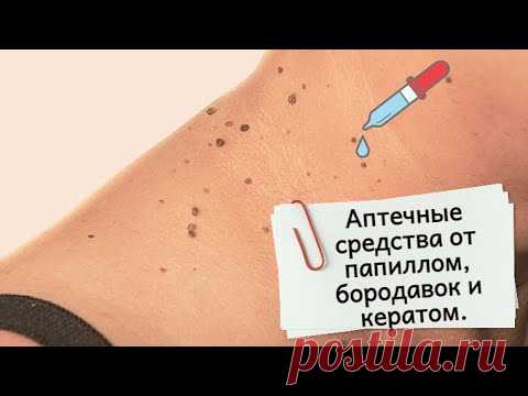 Аптечные средства от папиллом, от кератом, об мозолей и от бородавок. Убрать папилломы за 1 раз.