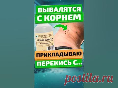 Как избавиться от папиллом быстро и дёшево?Нанесите на каждую бородавку трёхпроцентный раствор перекиси водорода. Делайте это три-пять раз в день. А дополнит...