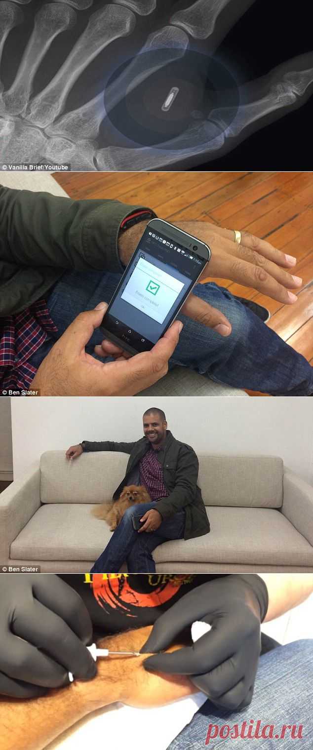 Австралиец внедрил в руку микрочип  для работы с iPhone 6