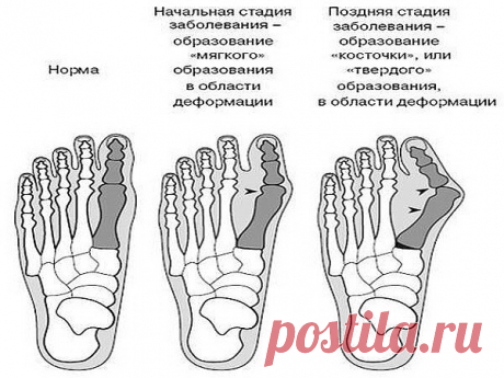 (13) Одноклассники