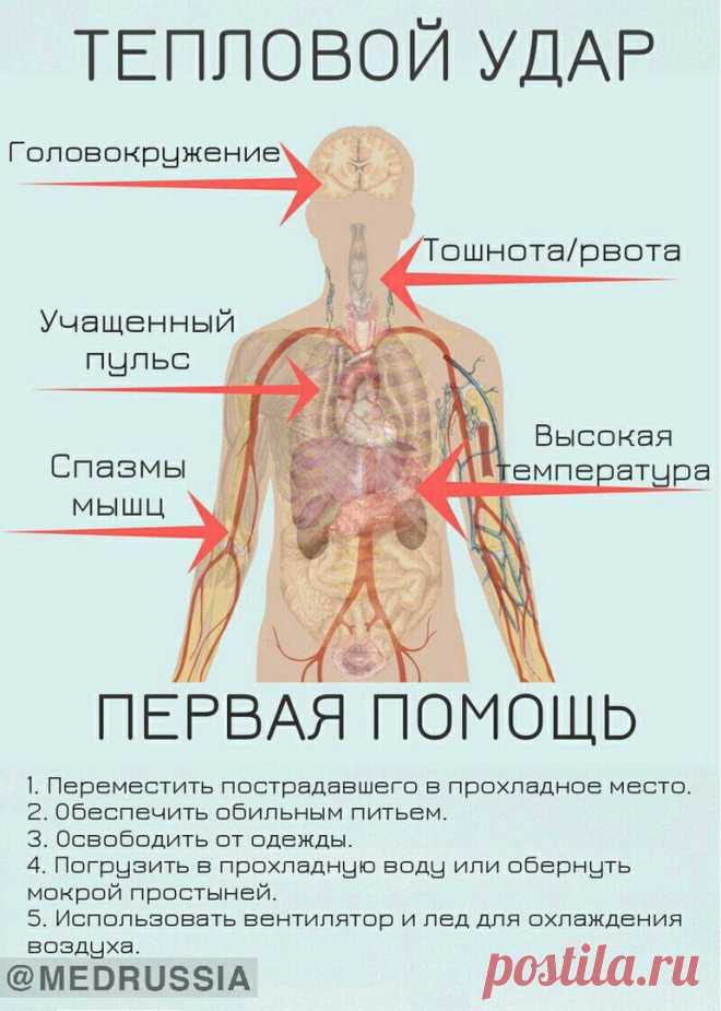 Что делать при перегреве на солнце взрослого. Тепловой удар. Симптомы солнечного и теплового удара. Первые симптомы теплового удара. Симптомы солнечных и тепловых ударов.