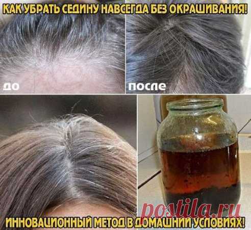 КАК УБРАТЬ СЕДИНУ НАВСЕГДА БЕЗ ОКРАШИВАНИЯ