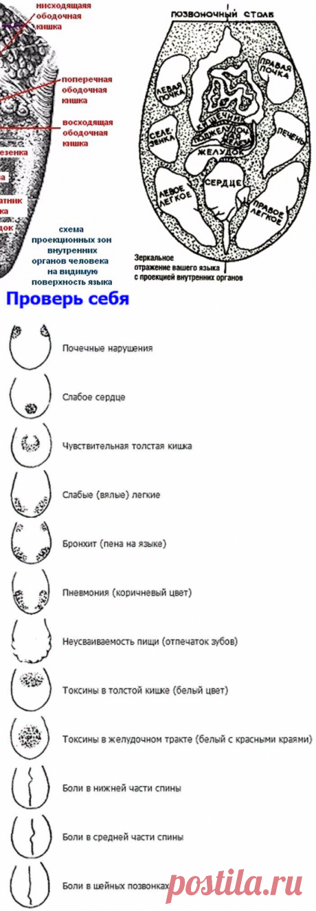 Проверьте себя! Язык расскажет о проблемах в организме