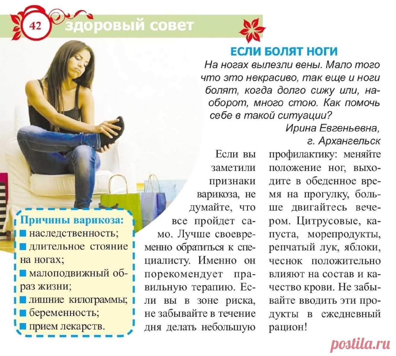 Варикоз
