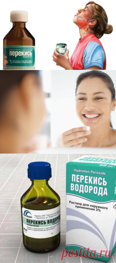 Перекись водорода: 11 способов использования в домашних условиях, о которых вы не знали