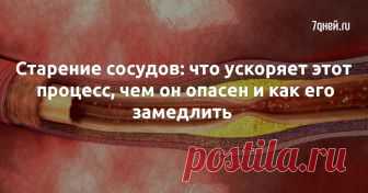 Старение сосудов: что ускоряет этот процесс, чем он опасен и как его замедлить  - 7Дней.ру Из-за каких привычек наши сосуды стареют ускоренно? Как сохранить здоровье сосудов?