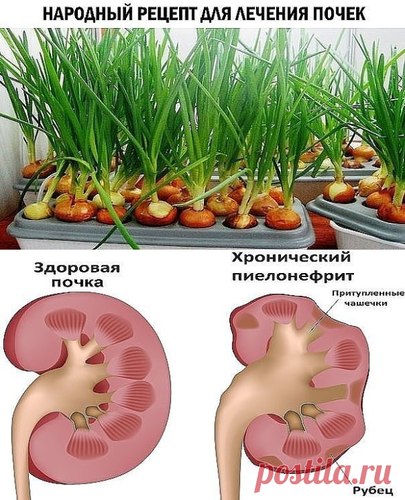 Лечение почек у мужчин в домашних условиях. Чем можно вылечить почки. Лечение почек в домашних условиях.