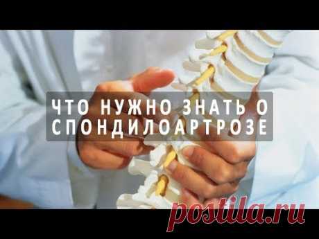 Что нужно знать о спондилоартрозе 1 и 2 степени