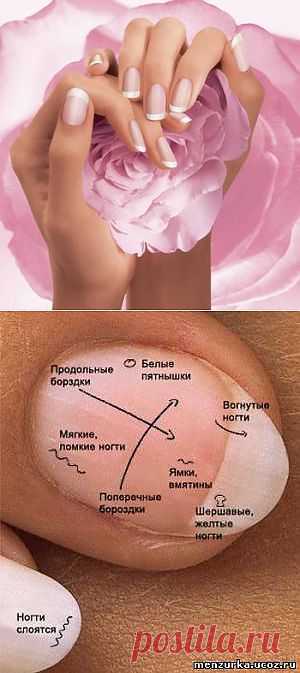 Диагностика болезней по ногтям - Восточная Медицина - Мензурка