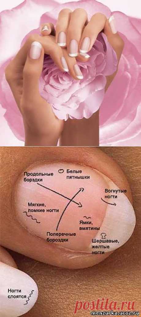 Диагностика болезней по ногтям - Восточная Медицина - Мензурка