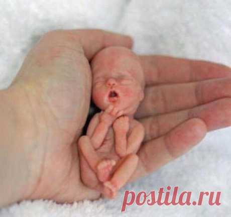 Вот так мы выглядим в 12 недель в материнской утробе. И таких нас легально убивают в большинстве стран и в 50 штатах Америки. Кто-то еще думает, что это НЕ человек?