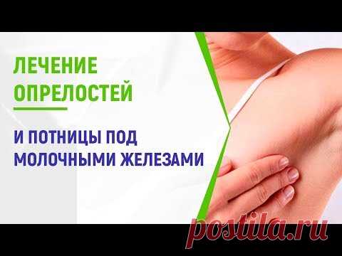 Потница под грудью у женщин фото лечение