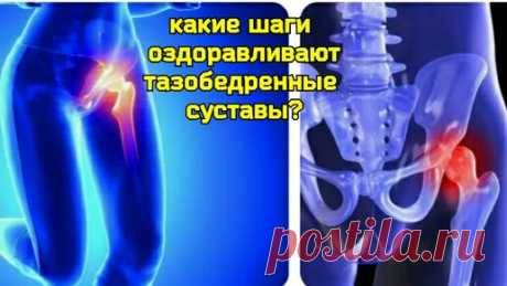 Как восстановить тазобедренные суставы? Помогут "волшебные" упражнения для правильной ходьбы | Причины Здоровья | Дзен