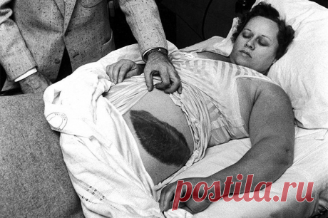 Энн Ходжес — единственный известный человек, пострадавший от прямого попадания метеорита | История
