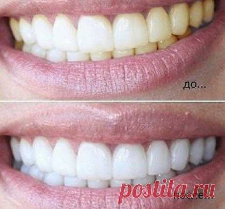 Натуральное отбеливание зубов