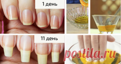 У меня все время ломались ногти... Пока подруга не посоветовала это средство! Каждой женщине хотелось бы иметь длинные крепкие ногти, пишет Manicure. На таких ногтях любой маникюр будет выглядеть сногшибательно. Что же делать, если ногтевые пластины стали ломкими, начали слоиться и...