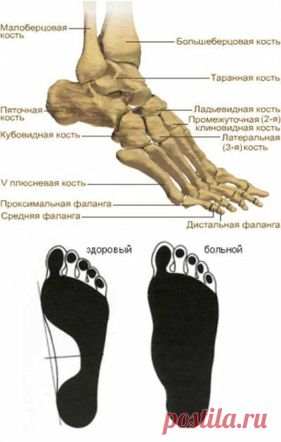 Почему болит стопа сверху. Болит стопа сверху посередине.