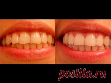 ▶ Как отбеливать зубы активированным углем? - YouTube
