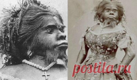 Хулия Пастрана - женщина с внешностью обезьяны, впечатлившая самого Дарвина