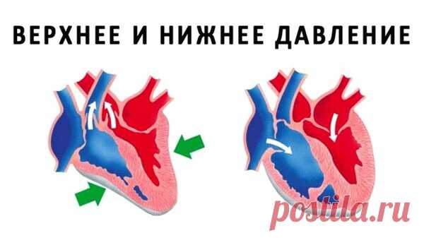 Верхнее и нижнее давление – что нужно знать каждому | На каблуке | Яндекс Дзен