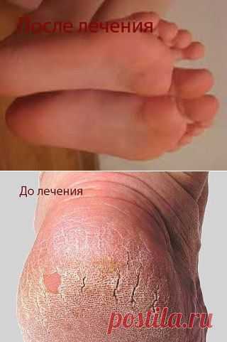 (30) Одноклассники
