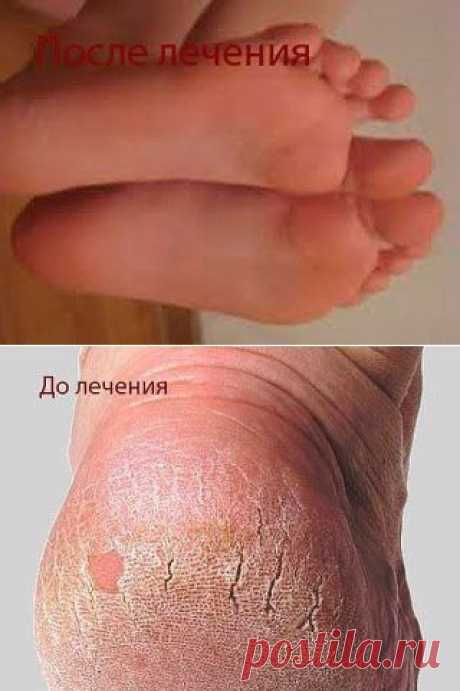 (30) Одноклассники