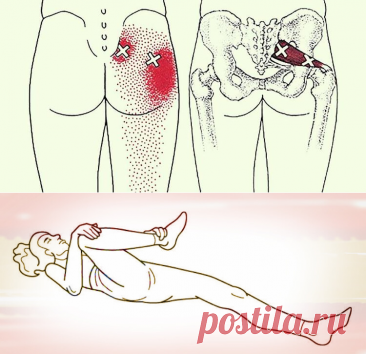 2 трюка, которые разблокируют седалищный нерв и облегчат боль в течение нескольких минут! — Journal women❜s