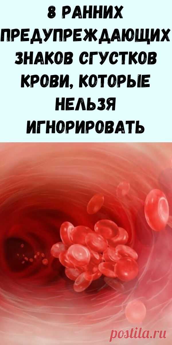 8 ранних предупреждающих знаков сгустков крови, которые вы не должны и ...