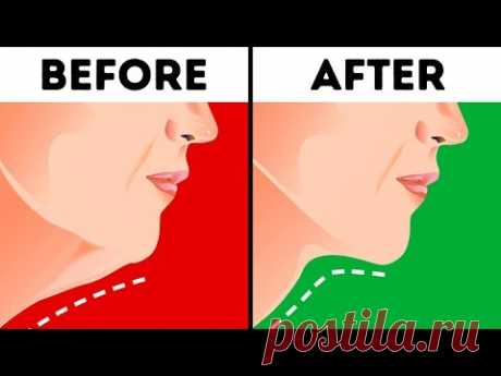 6 Effective Ways to Get Rid of a Double Chin