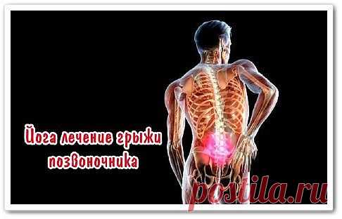 Йога лечение грыжи позвоночника