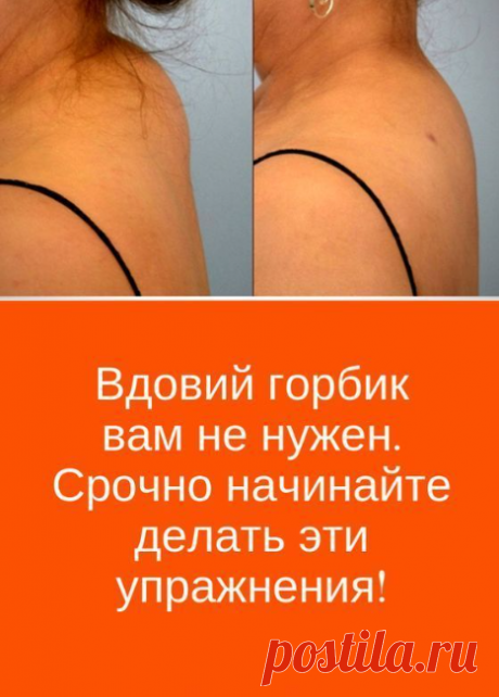 Вдовий горбик вам не нужен. Срочно начинайте делать эти упражнения! (видео) пасхальные веночки