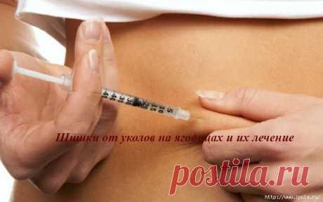 Шишки от уколов на ягодицах и их лечение