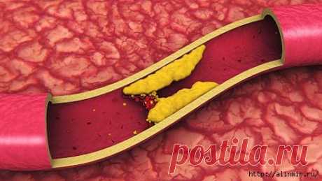 ПОЧИСТИТЕ СВОИ СОСУДЫ! ЭТО ЛЕГКО!     Чистка сосудов и поддержание их в хорошем состоянии является залогом здоровья и долголетия, потому что здоровые сосуды – это гарант нормального состояния кровеносной и сердечно-сосудистой системы и профилактика …