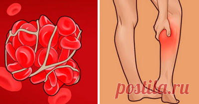 УЗНАЛ САМ - РАССКАЖИ ДРУГОМУ!: Признаки тромбов в кровеносных сосудах, и что делать, если вы их обнаружили