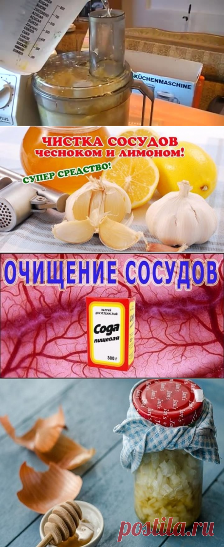 (75) Одноклассники