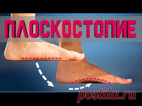 5 простых упражнений от Плоскостопия на каждый день!