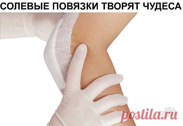 А ВЫ ЗНАЕТЕ, ЧТО СОЛЕВЫЕ ПОВЯЗКИ ТВОРЯТ ЧУДЕСА?