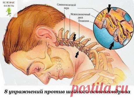 ПОЛЕЗНЫЕ СОВЕТЫ : 
Сохраните, чтобы не потерять.

СОВЕТ 1 : Восемь упражнений против шейного остеохондроза

Первые проявления шейного остеохондроза — боли в спине, головные боли, головокружение, "мушки" в глазах, ухудшение слуха или шумы, а также покачивание при ходьбе в результате нарушения координации.

Чтобы этого не случилось, предлагаем нехитрые упражнения, которые помогут вам победить остеохондроз и сберечь здоровье.

1. Подбородок опустите к шее. Поверните голову сн...