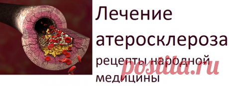 Лечение атеросклероза. Рецепты народной медицины | Советы целительницы