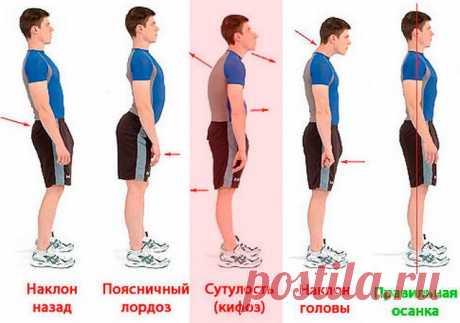 Здоровая спина — красивая осанка — Всегда в форме!