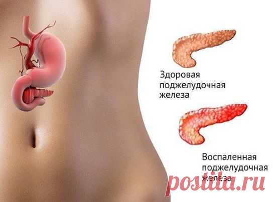 (57) Одноклассники