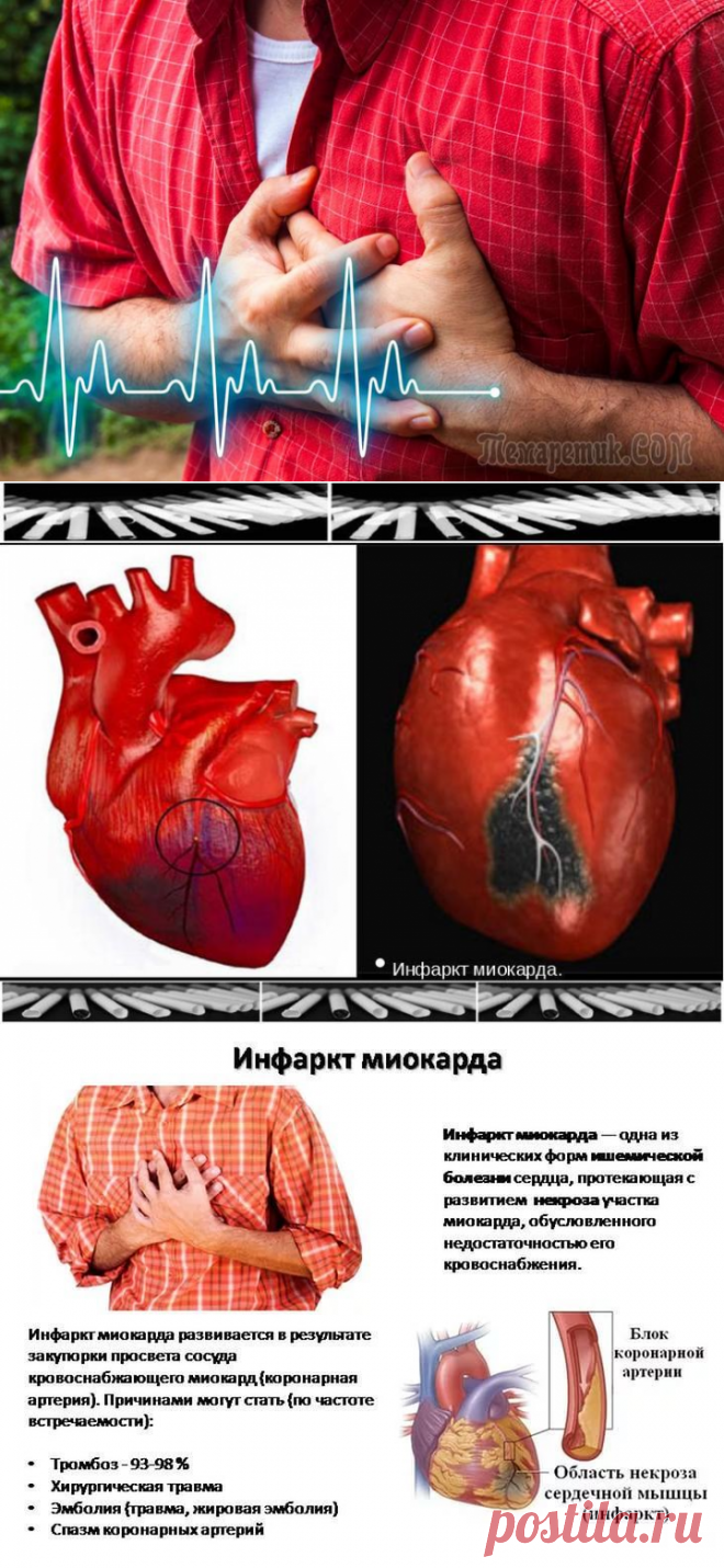 Чем грозит ишемия сердца
