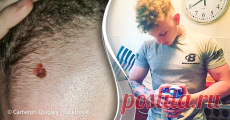 «Неудачная стрижка спасла мне жизнь»: 21-летний парень заметил предупреждающий знак после испорченной причёски . Милая Я