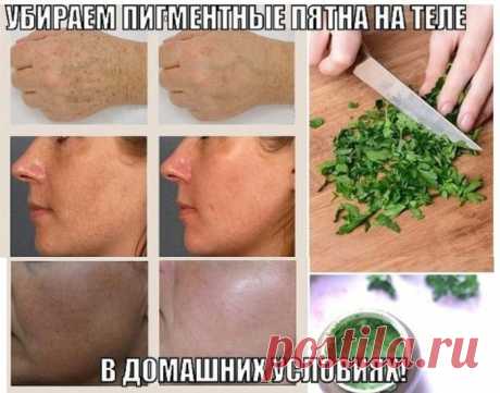УБИРАЕМ ПИГМЕНТНЫЕ ПЯТНА