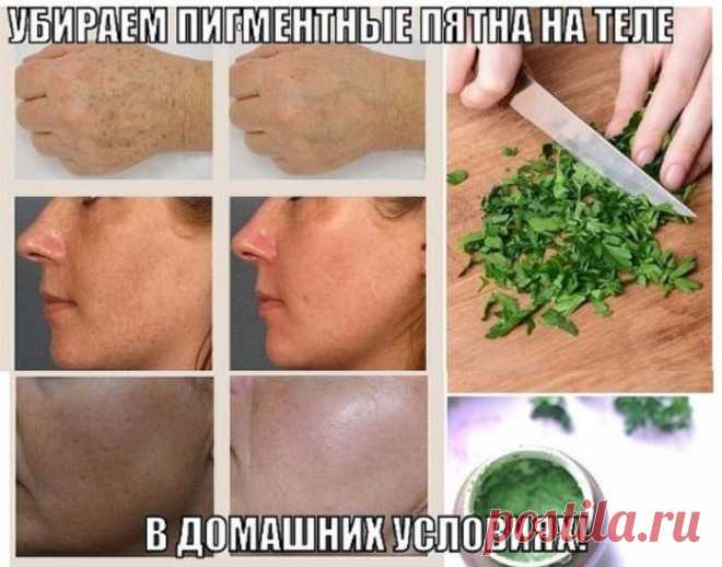 УБИРАЕМ ПИГМЕНТНЫЕ ПЯТНА